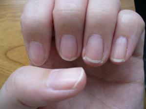 Moje nehty pred p-shine...