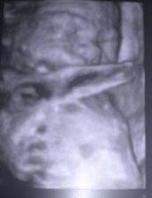 7.12 2012 se nám narodil druhy šmudlíček Kubíček