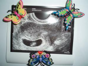 7/2010 Dali jsme si trochu pauzičku.......Jupííííí bude miminko. Takže honem do práce, ať už můžu hnízdit :-)